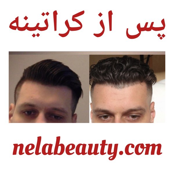 پس از کراتینه