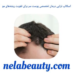 اسکالپ تراپی درمان تخصصی پوست سر برای تقویت ریشه‌های مو